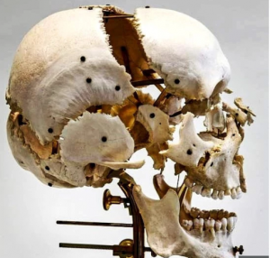 Онлайн-бизнес по продаже черепов набирает обороты